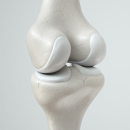 ”膝が痛い”ときの検査と治療の基本