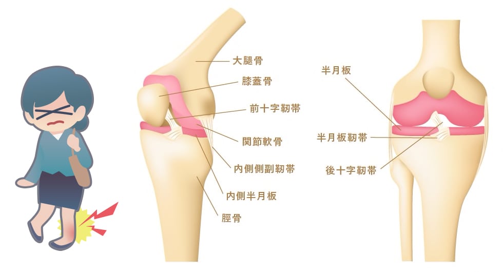 捻挫