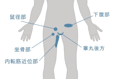 鼠径部痛症候群