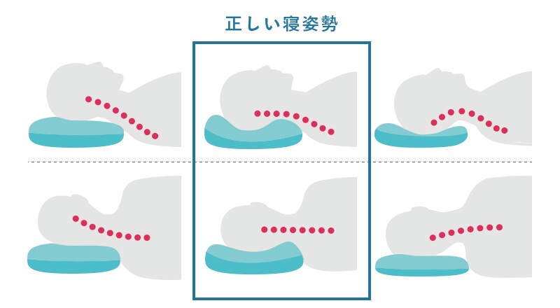 寝違え