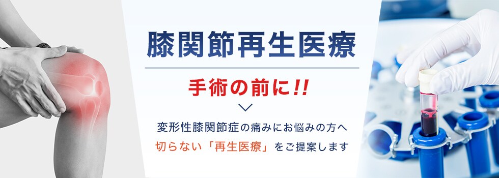 変形性膝関節症の痛みにお悩みの方へ切らない「再生医療」をご提案します
