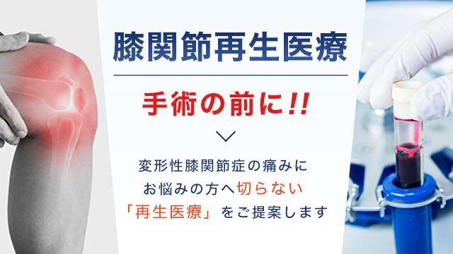 変形性膝関節症の痛みにお悩みの方へ切らない「再生医療」をご提案します