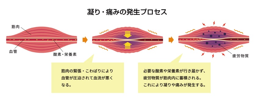 肩こり