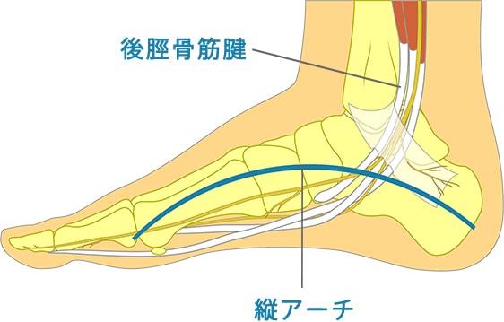 外反母趾