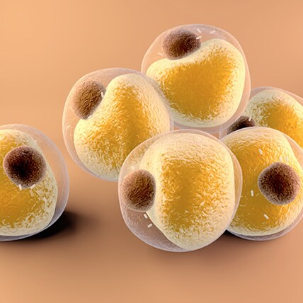 脂肪のパワーを利用して、変形性膝関節症を治療