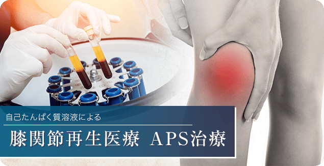 再生医療PRP治療