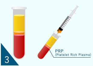 PRP生成工程03