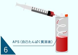 PRP生成工程06