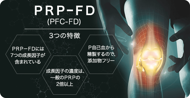 ひざ・肘・肩の再生医療PRP-FD(PFC-FD)