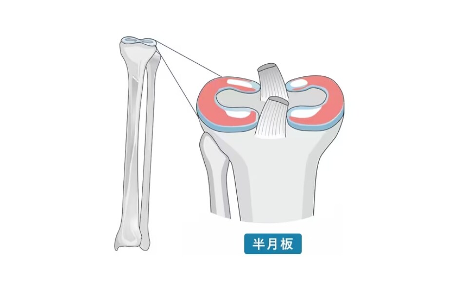 半月板損傷