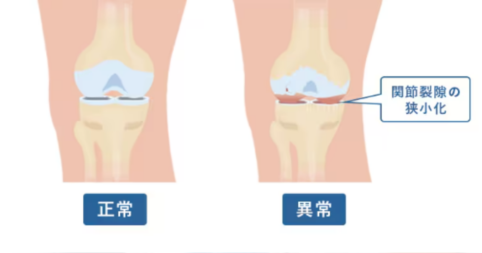 高濃縮PRP治療の対象疾患
