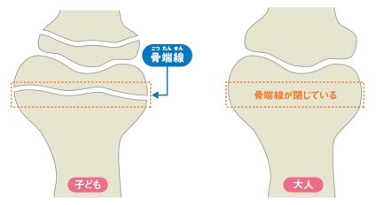 身長はなぜ伸びるのか 子供 小児の低身長治療なら西新宿整形外科クリニック